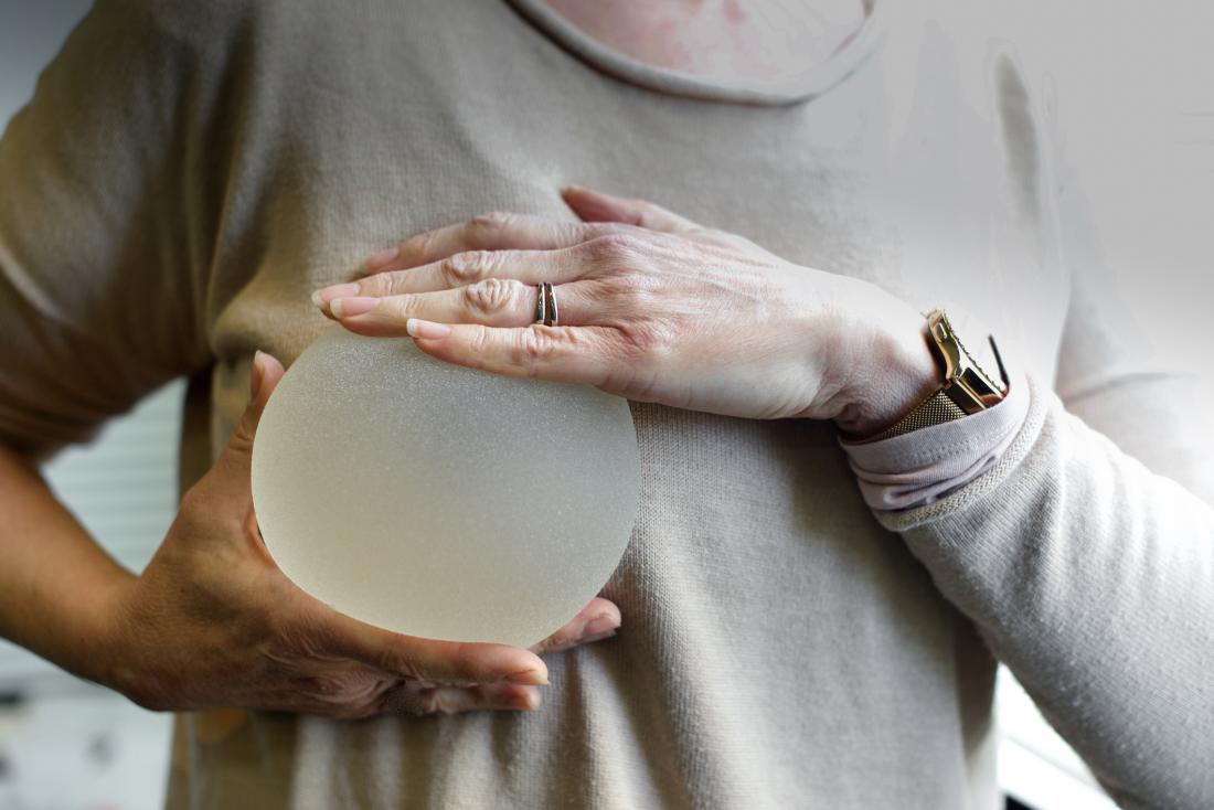 Breast implant: types, recovery process, possible complications